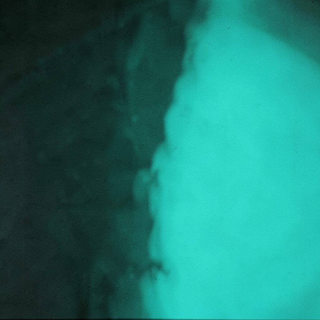 Duotone portrait in black and pale blue showing a face partially obscured by visual static and scanline artifacts